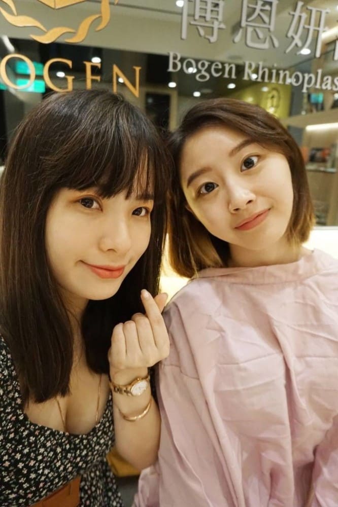 大小腿抽脂,大腿抽脂,小腿抽脂,馬鞍肉抽脂,抽脂手術,李岳樺醫師,博恩妍
